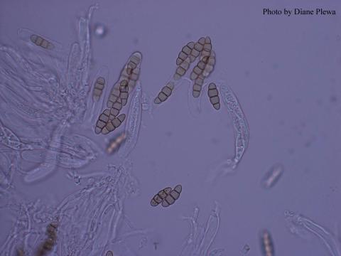 immature spores at 400X, photo by Diane Plewa